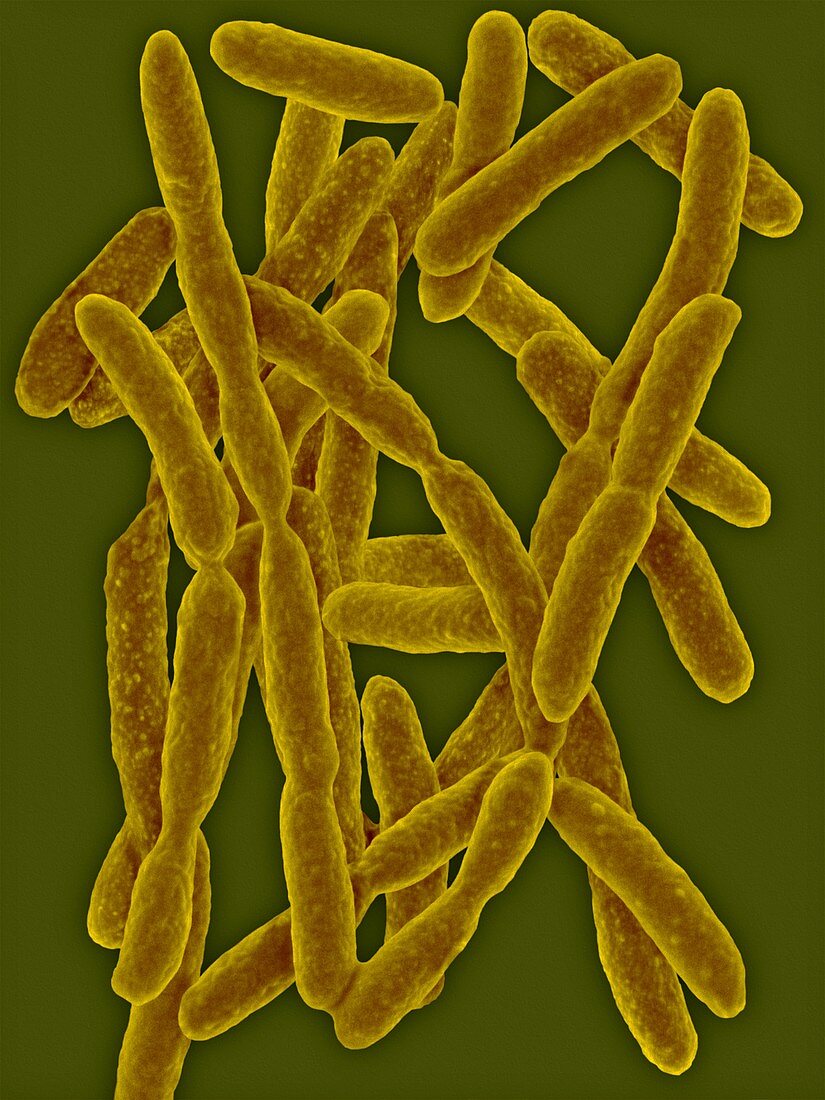 Flavobacterium akiainvivens, SEM