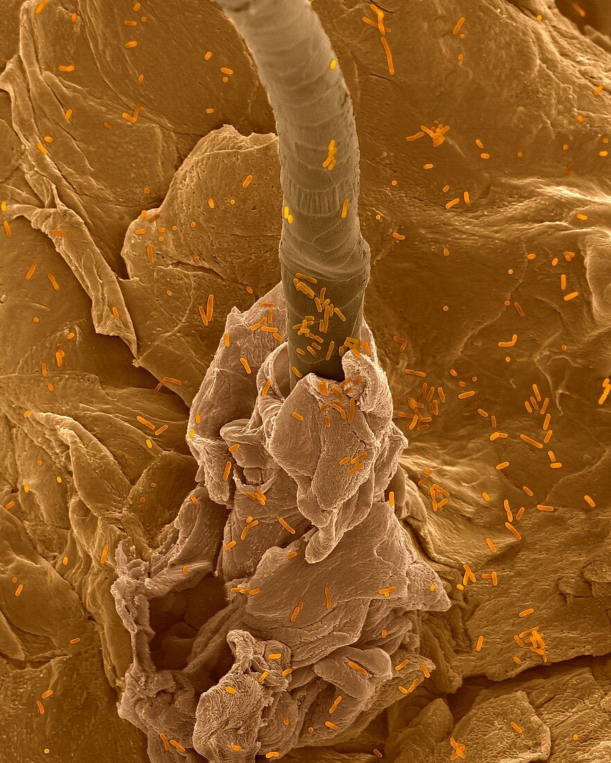 E. coli on human skin and hair follicle, SEM