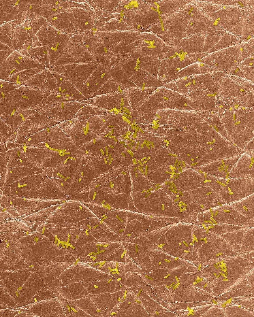 E. coli on the surface of human skin, SEM