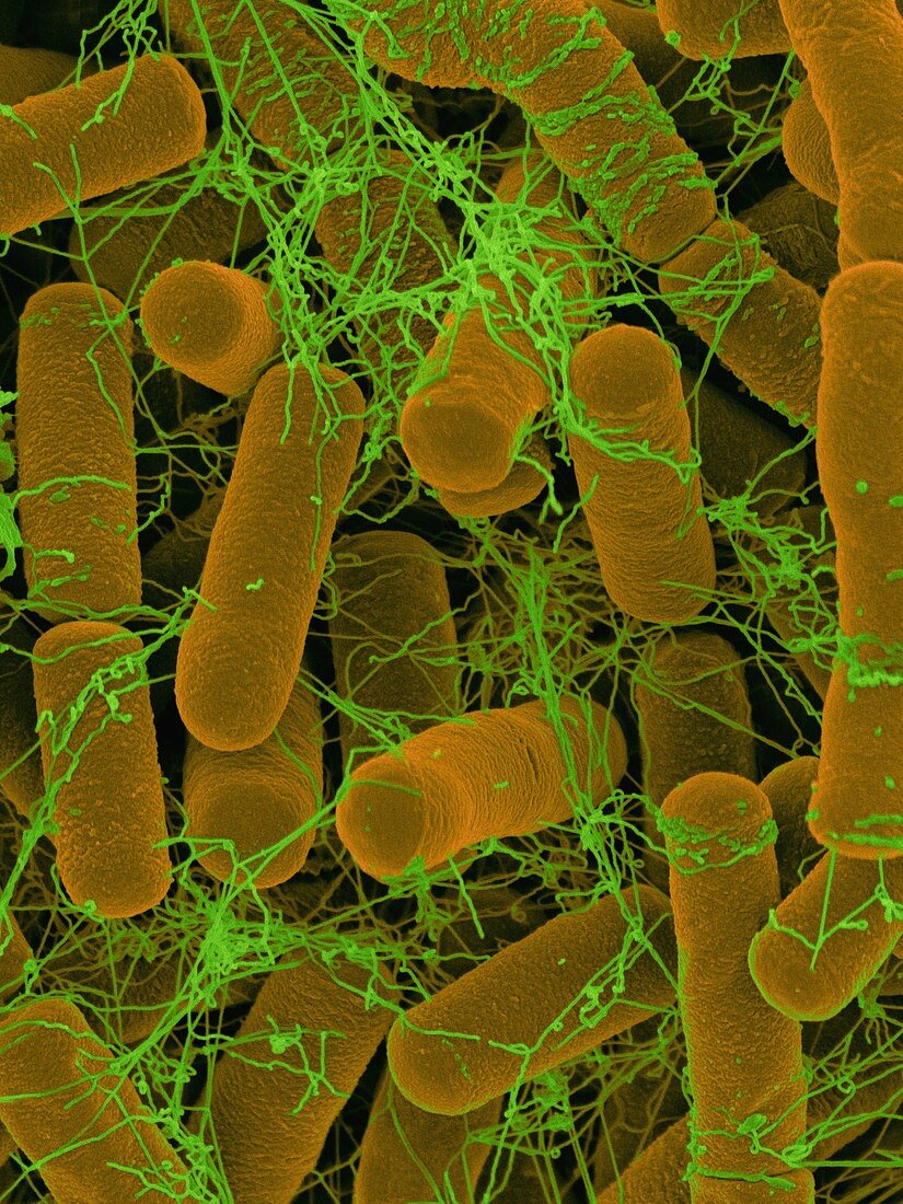 Bacillus thuringiensis, soil bacterium, SEM