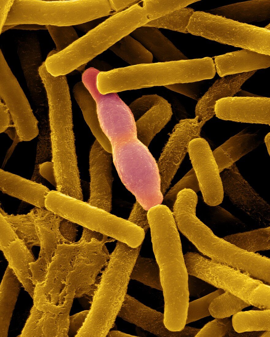 Bacillus anthracis, SEM