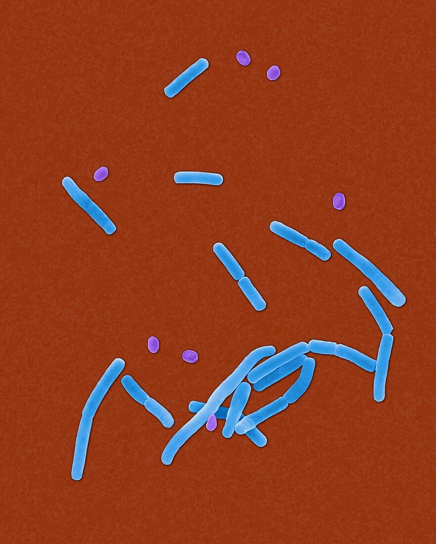 Bacillus anthracis, spore, prokaryote, SEM