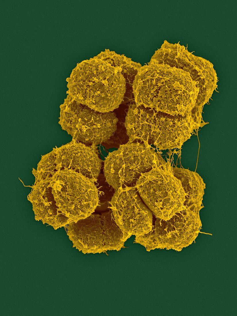 Micrococcus antarcticus, bacterium, SEM