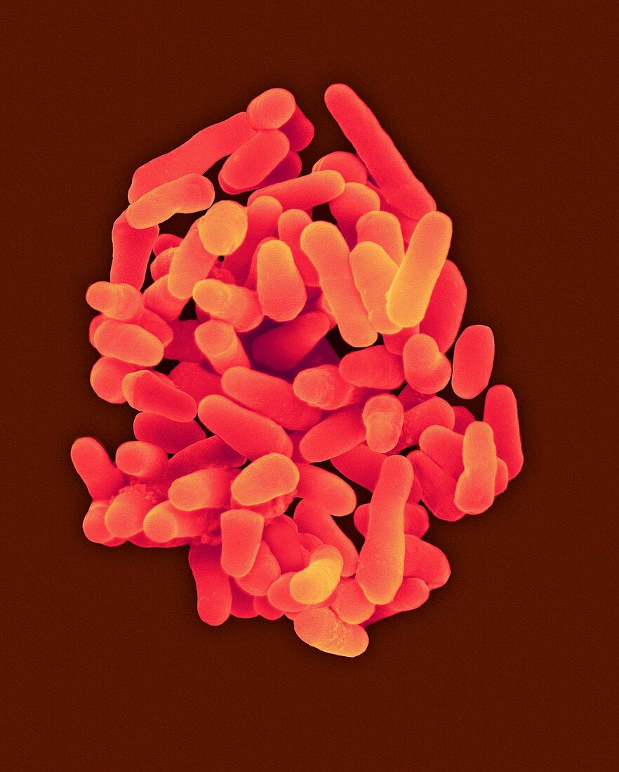 Mycobacterium tuberculosis, SEM