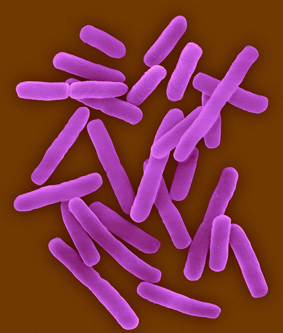 E. coli (0157:H7), rod, haemorrhagic bacterium, SEM