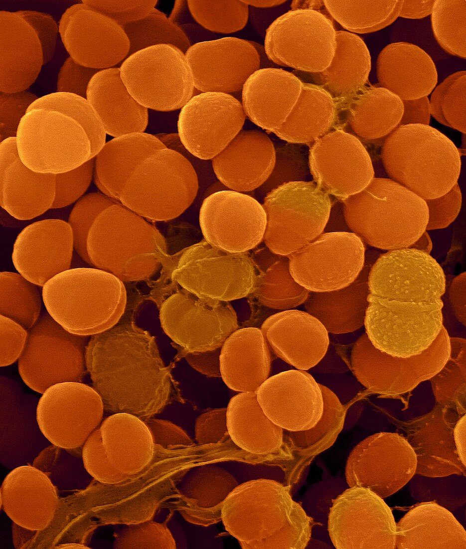 Staphylococcus haemolyticus, SEM