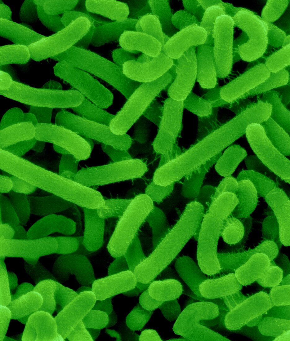 Agrobacterium tumefaciens, SEM