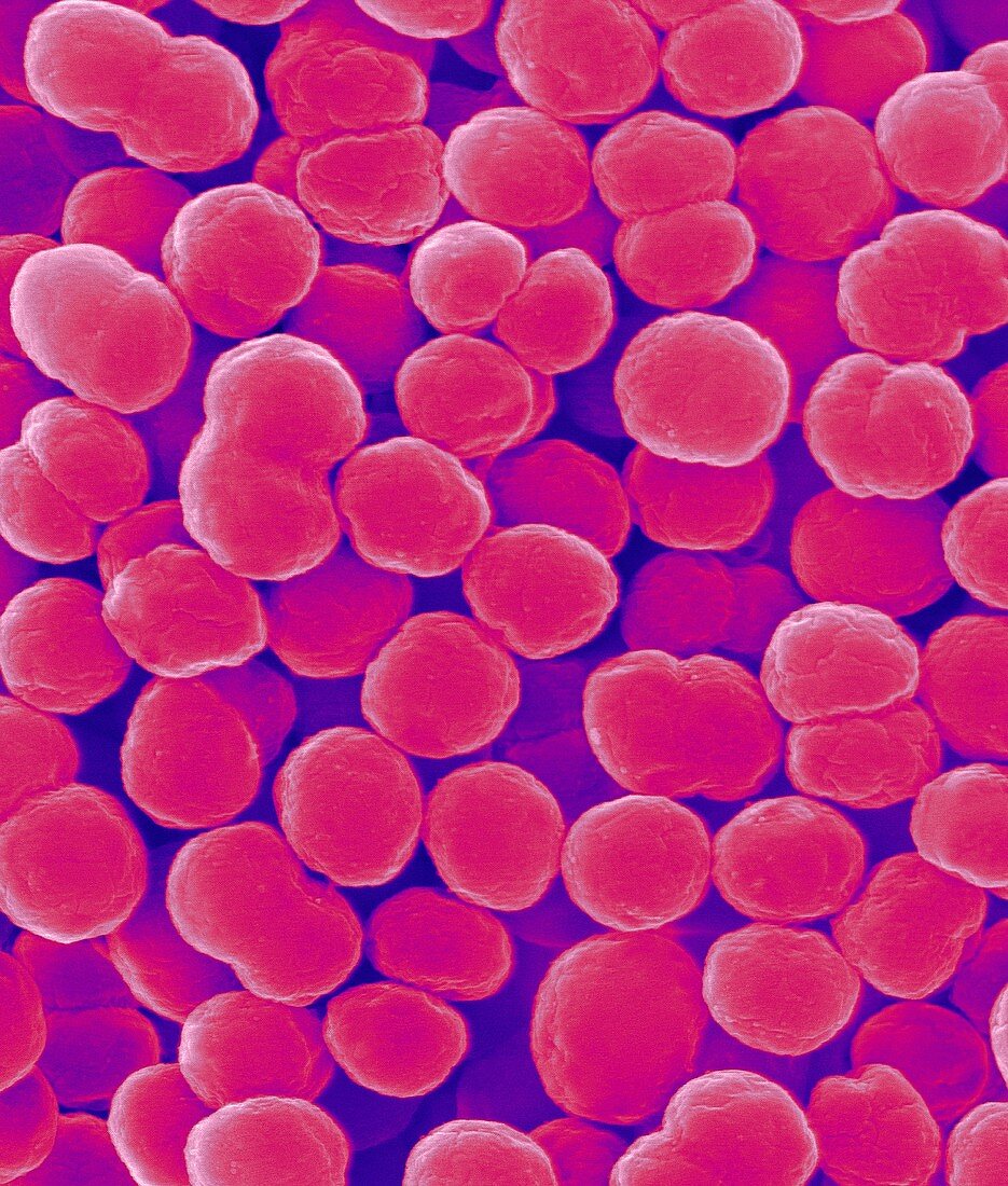 Methylococcus capsulatus, SEM