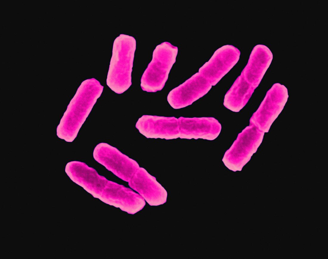 E. coli, SEM