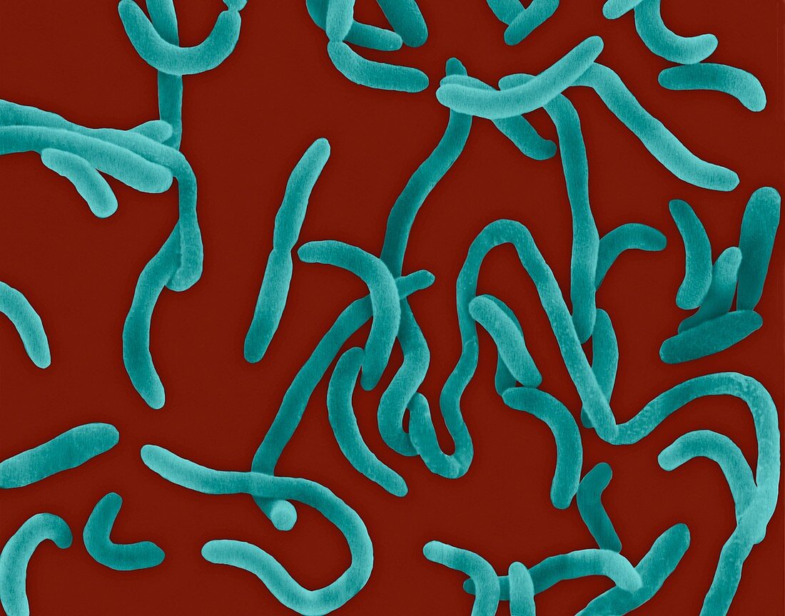 Vibrio cholerae, curved rod prokaryote, SEM