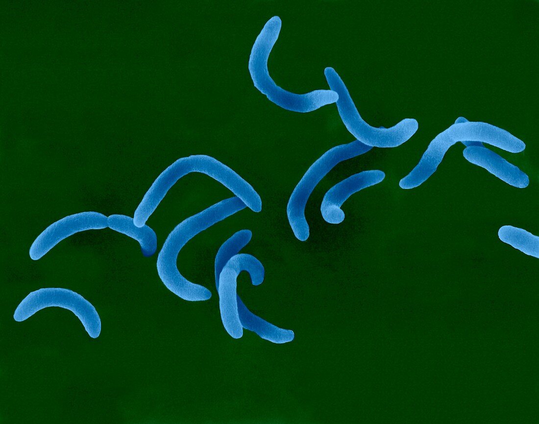 Vibrio cholerae -curved rod prokaryote, SEM