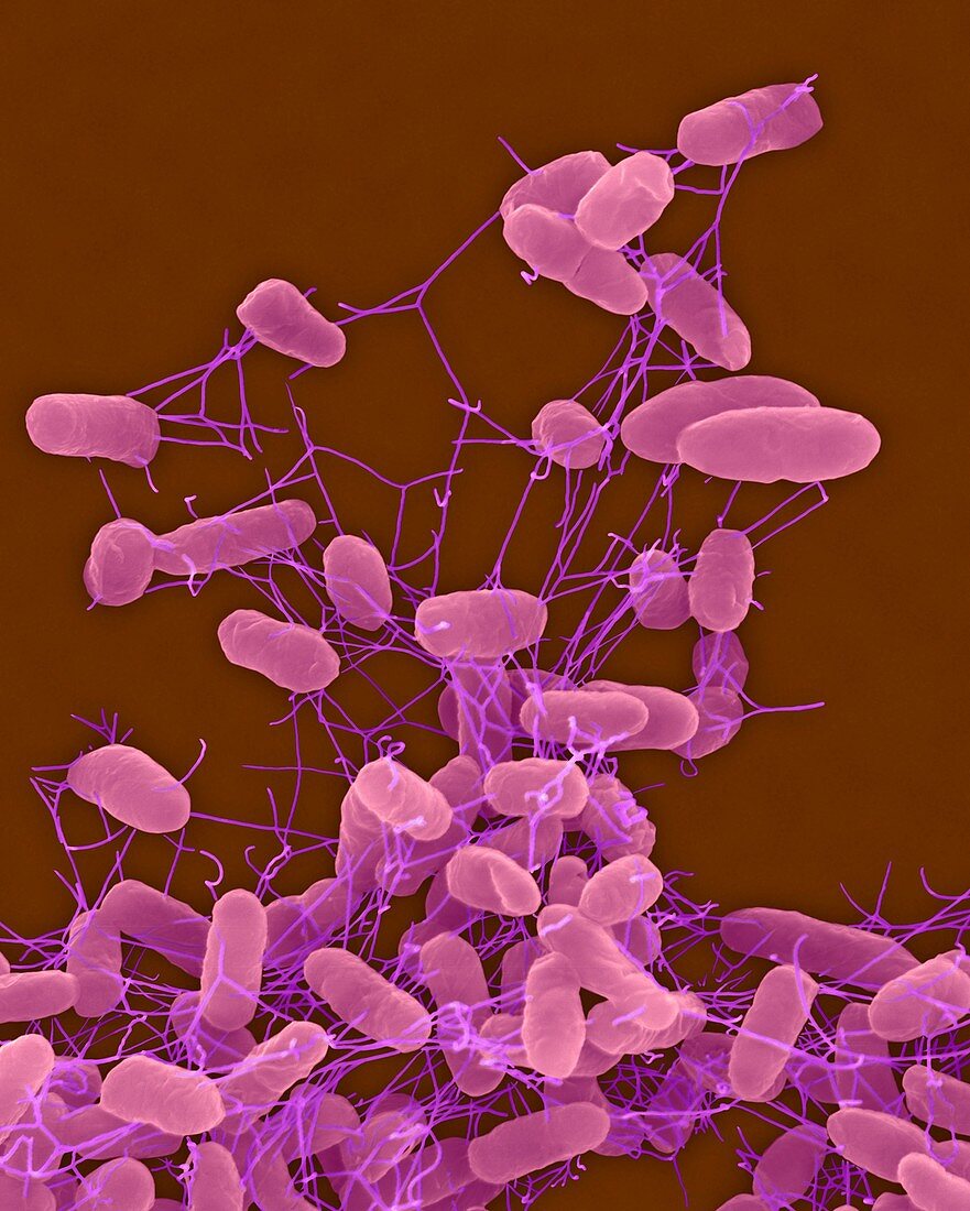 Salmonella enteritidis, bacterium, SEM