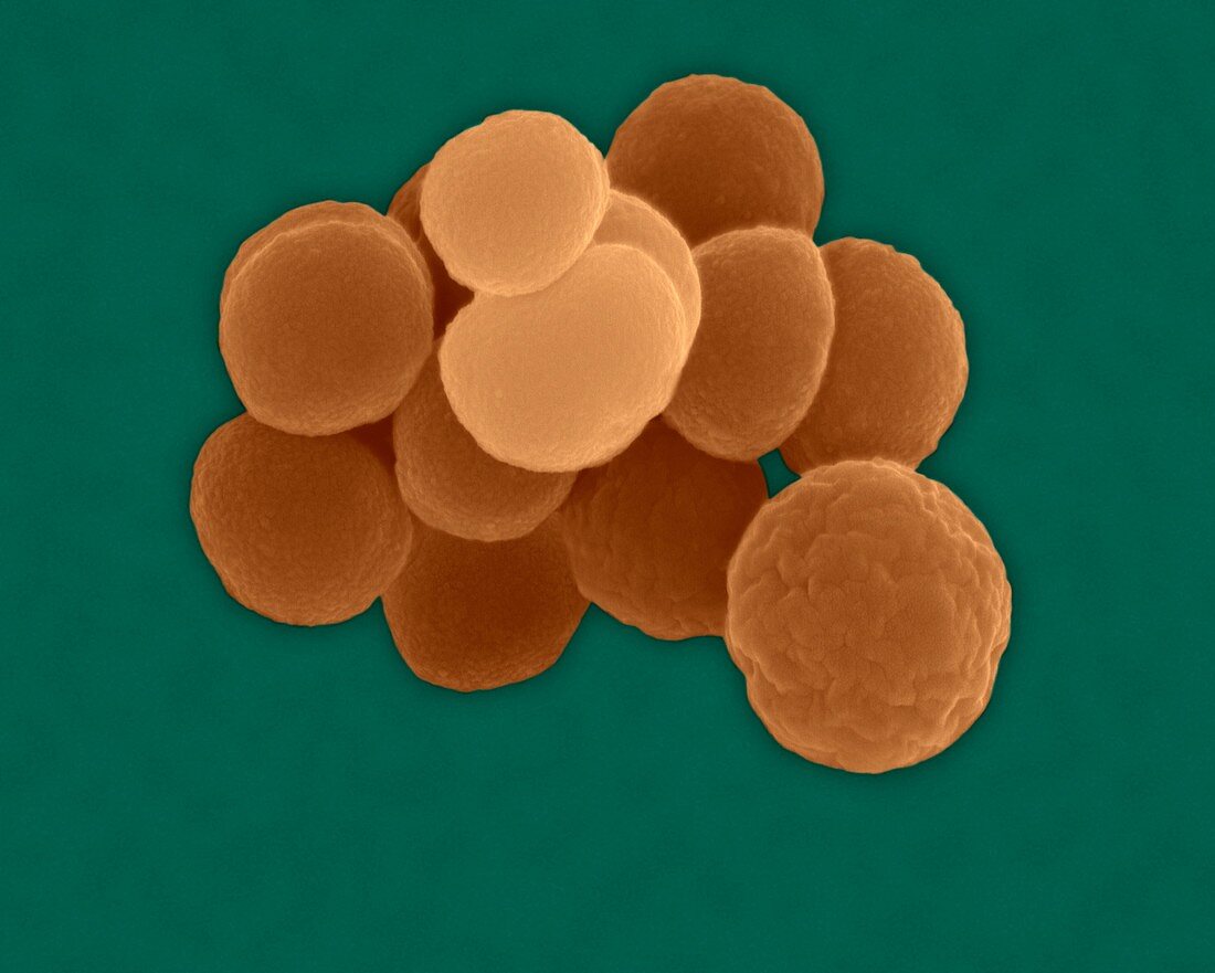 Neisseria gonorrhoeae, coccus prokaryote, SEM