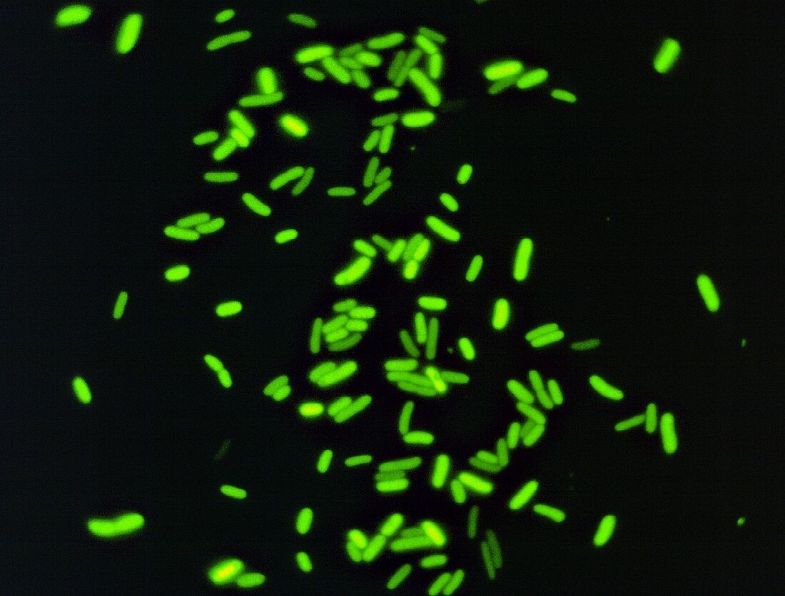 Transformed bacteria (E. coli) containing GFP, LM