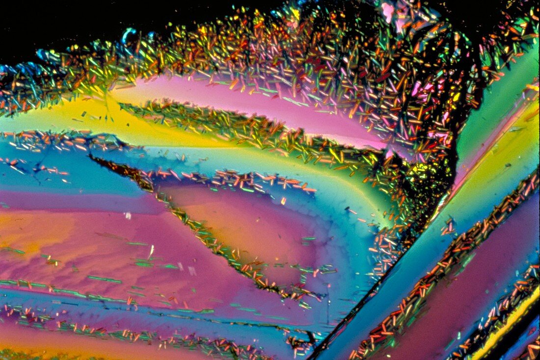 Uric acid crystals, LM