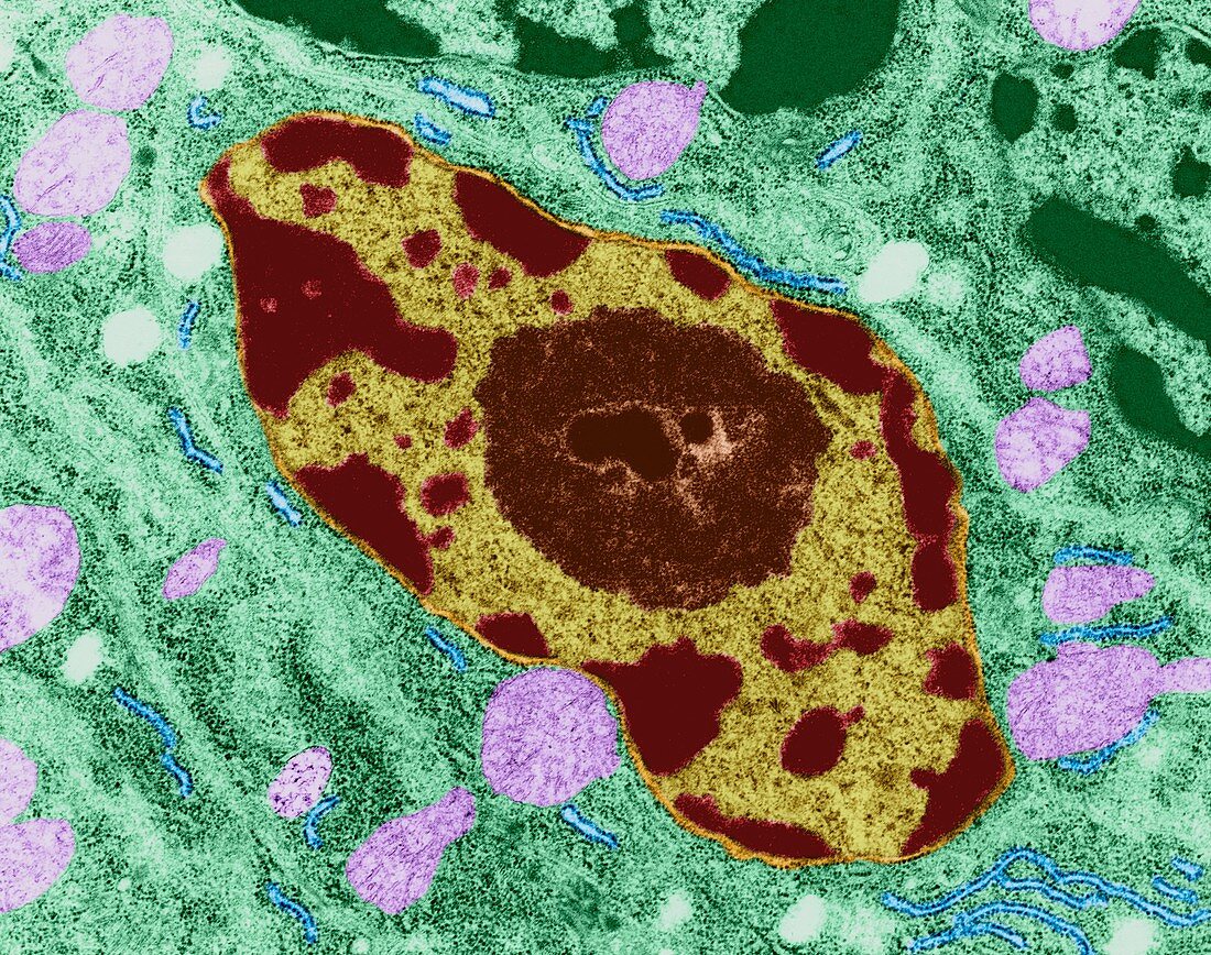 Nucleus from a glial cell, TEM