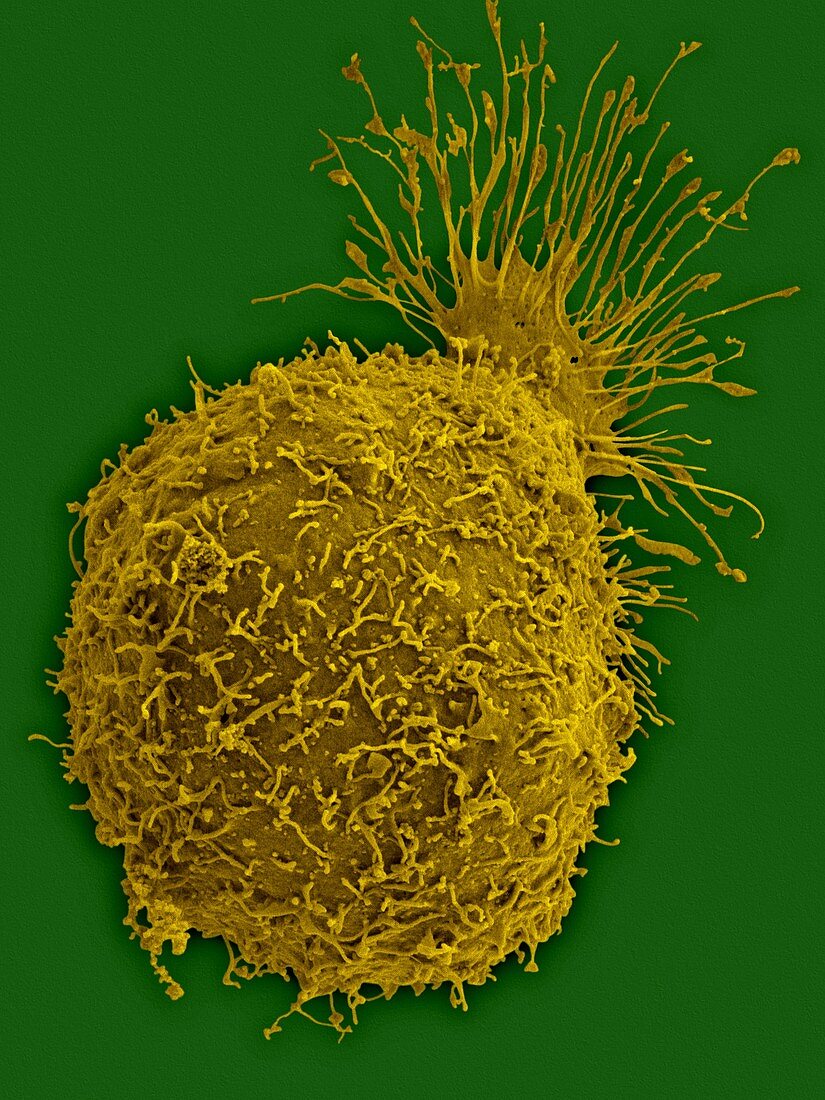 Insect ovary cell, SEM