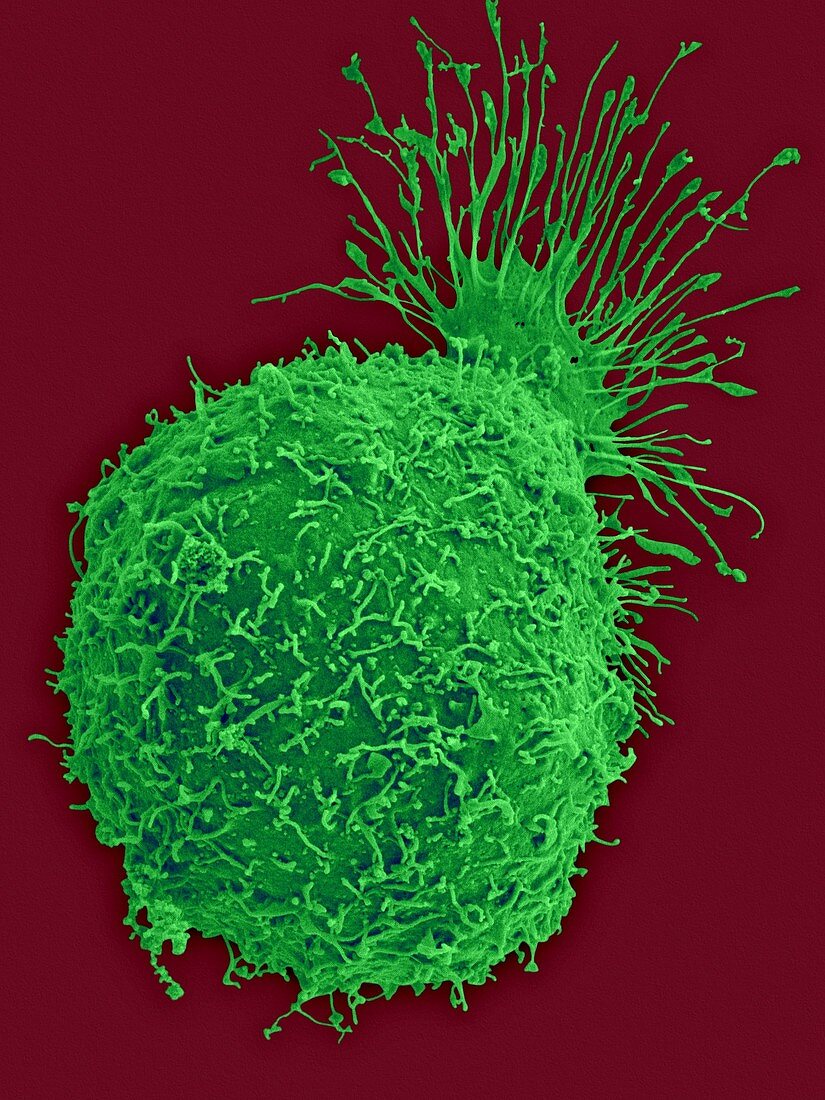 Insect ovary cell, SEM