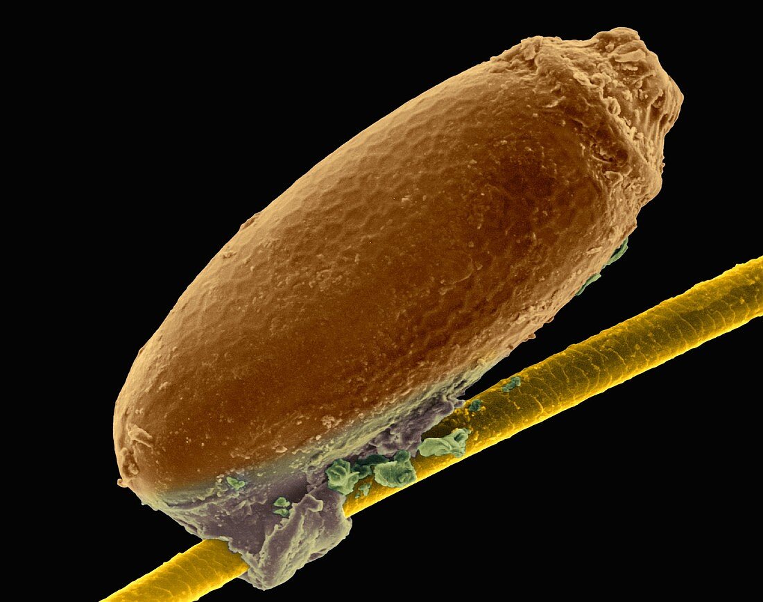 Louse egg case attached to a hair, SEM