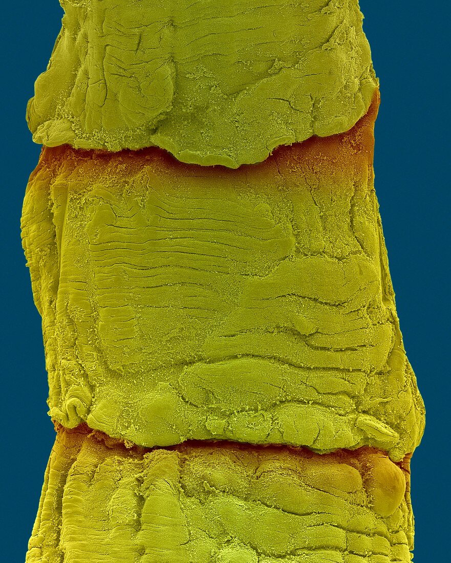 Tapeworm proglottids (Taenia sp.), SEM