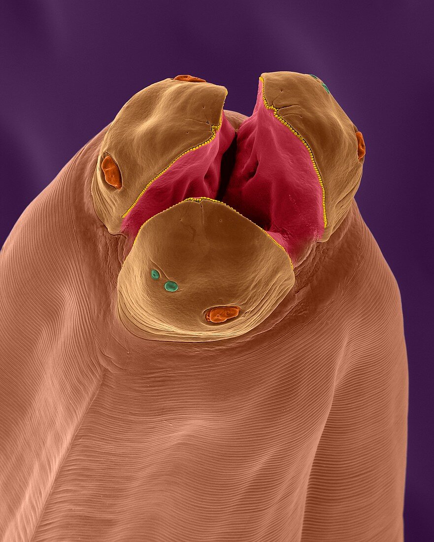 Dog intestinal roundworm (Toxocara canis), SEM