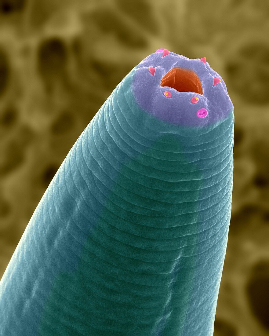 Soil nematode stomodeum (Caenorhabditis elegans), SEM