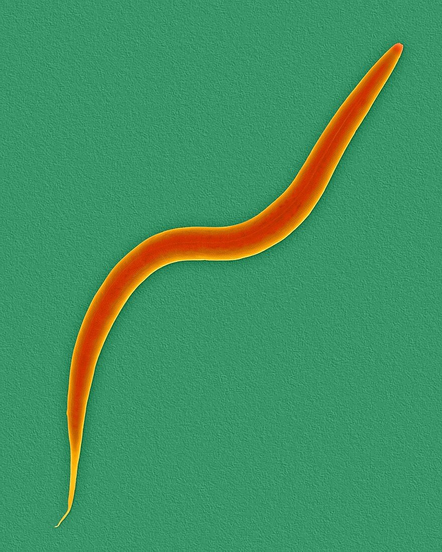 Soil nematode (Caenorhabditis elegans), SEM