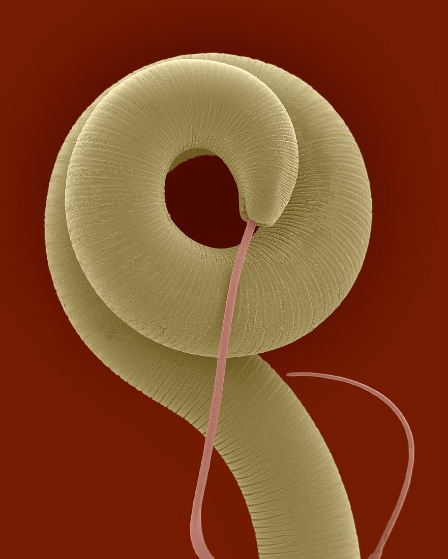 Nematode (Trichuris sp.) helminth (whipworm), SEM