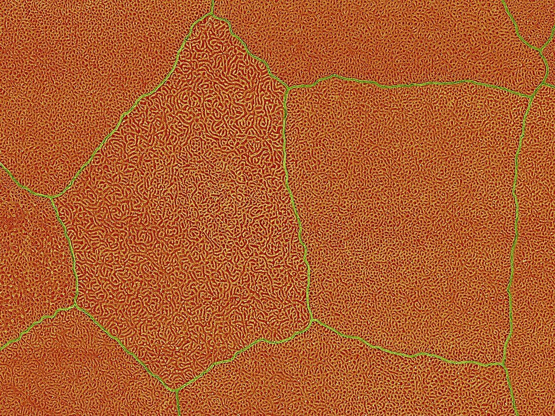 Frog tympanum cell surface, SEM