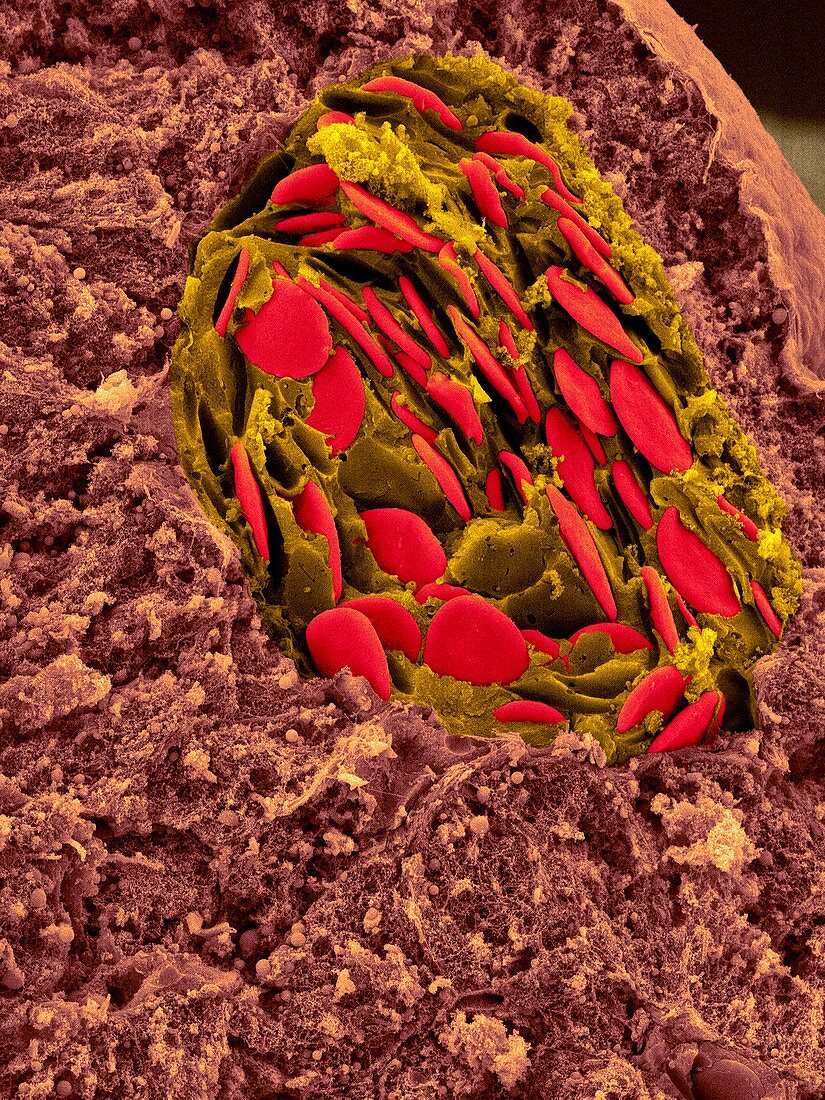 Frog blood in liver blood vessel, SEM