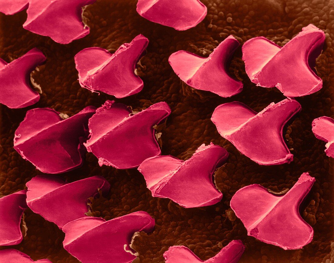 Dogfish (shark) skin with denticles, SEM