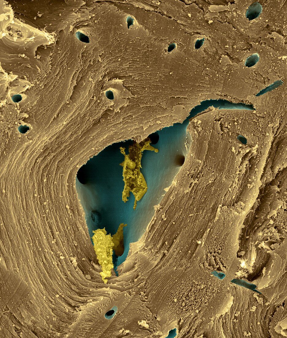 Pear sclereid or stone cell (Pyrus sp.), SEM