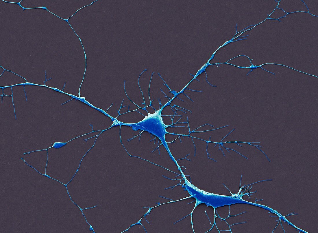 Neurones, SEM