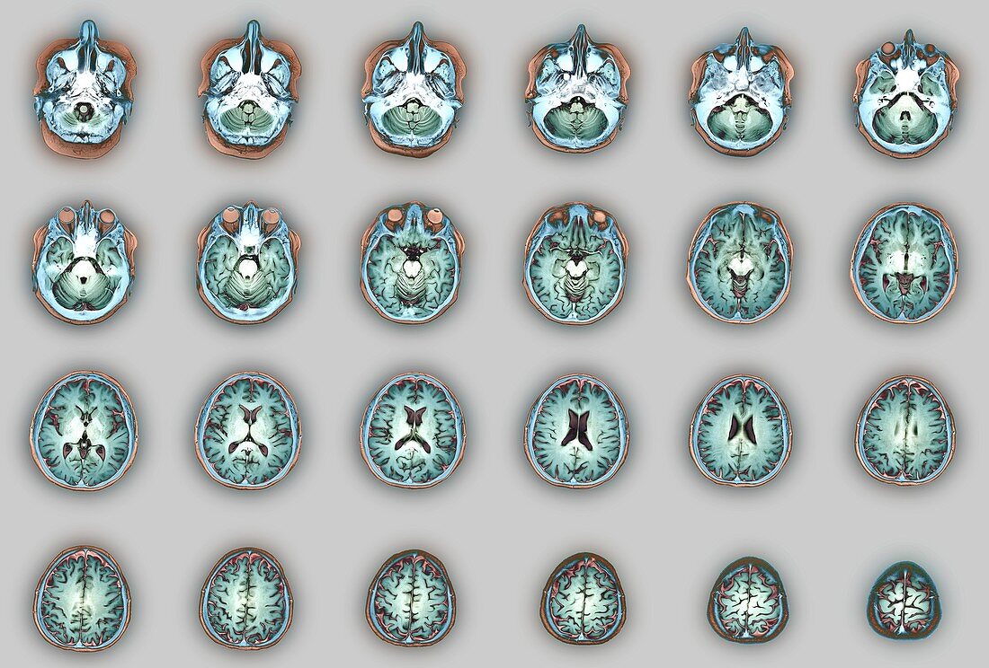 Human brain anatomy, MRI scans