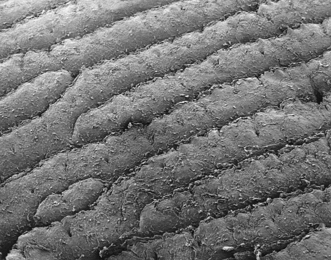 Grooves and ridges of the skin
