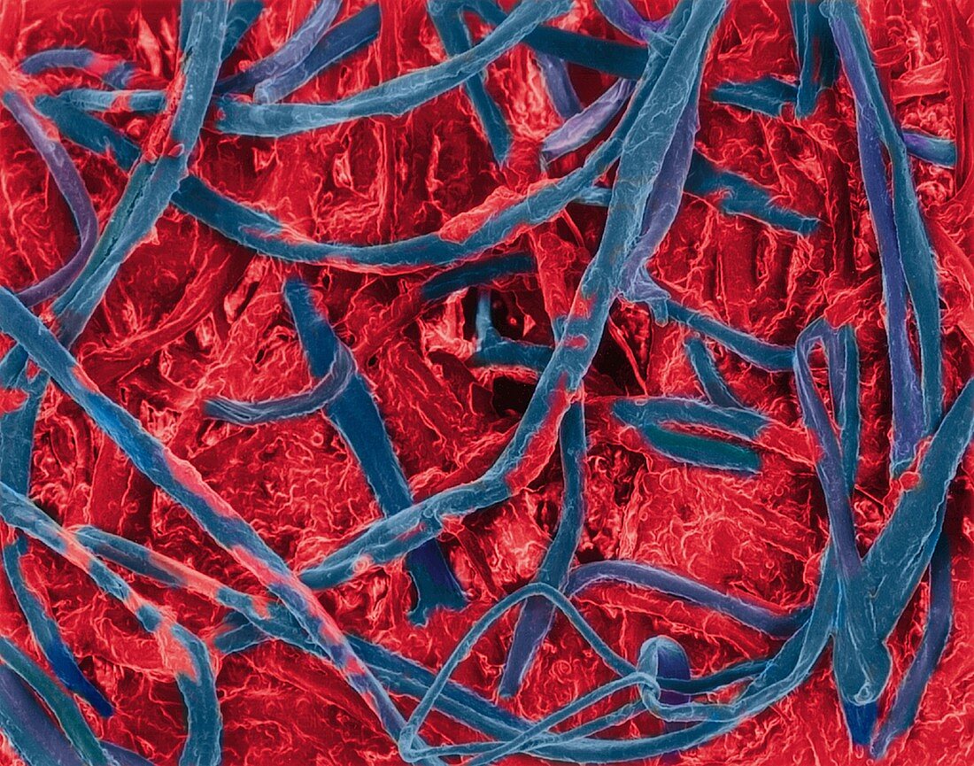 Cotton bud with ear wax embedded in fibres, SEM