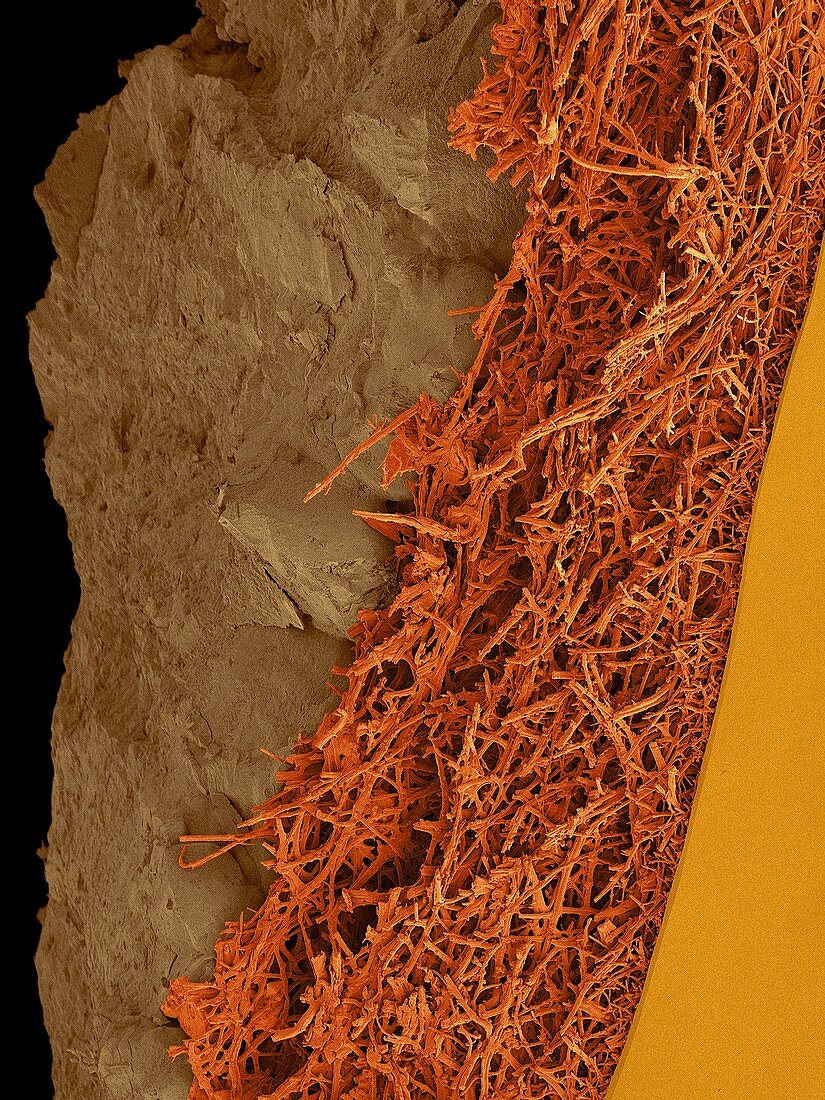 Chicken eggshell cross section, SEM