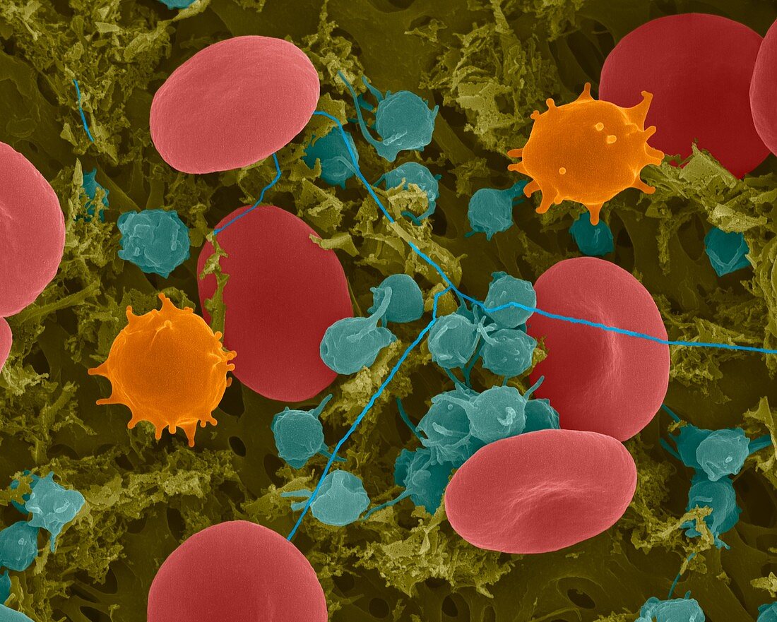 Red blood cells, monocytes, platelets and fibrin, SEM