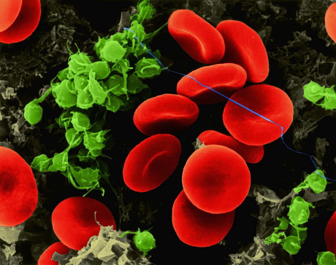 Red blood cells, platelets, fibrin, SEM