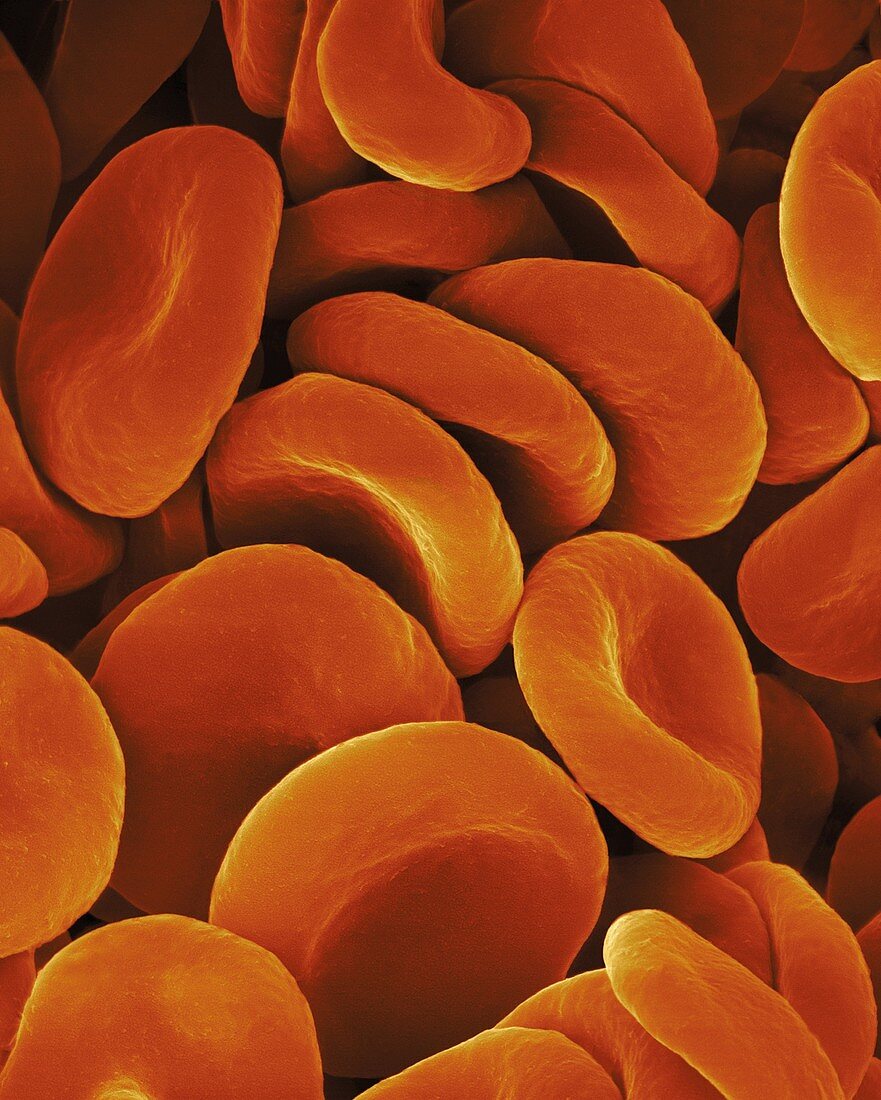 Human red blood cells, SEM