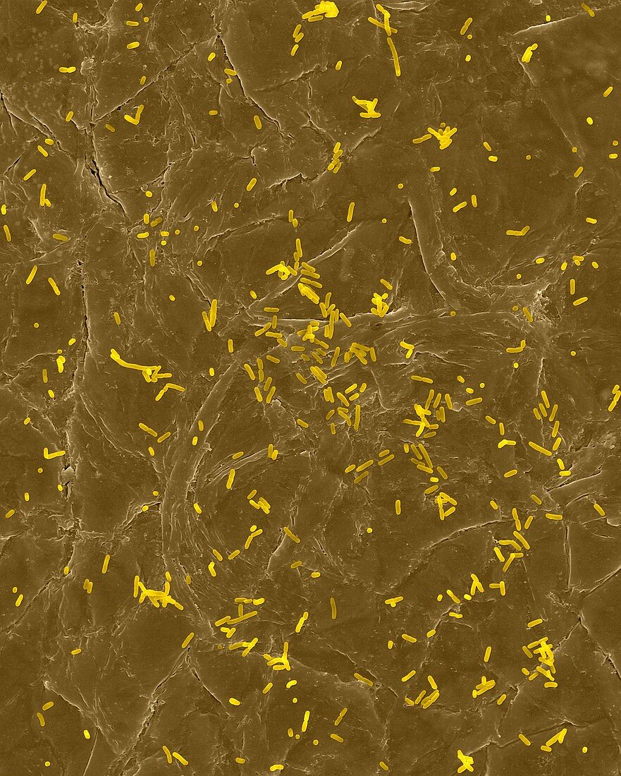 E. coli on the human skin surface, SEM