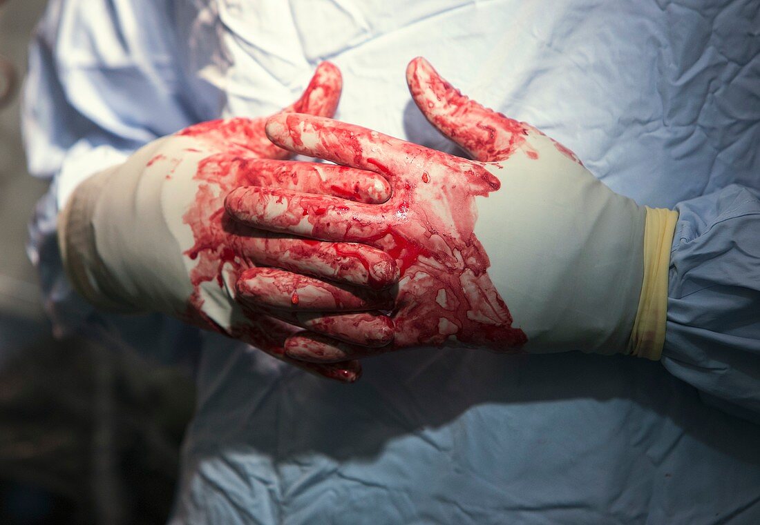 Bloodied surgeon