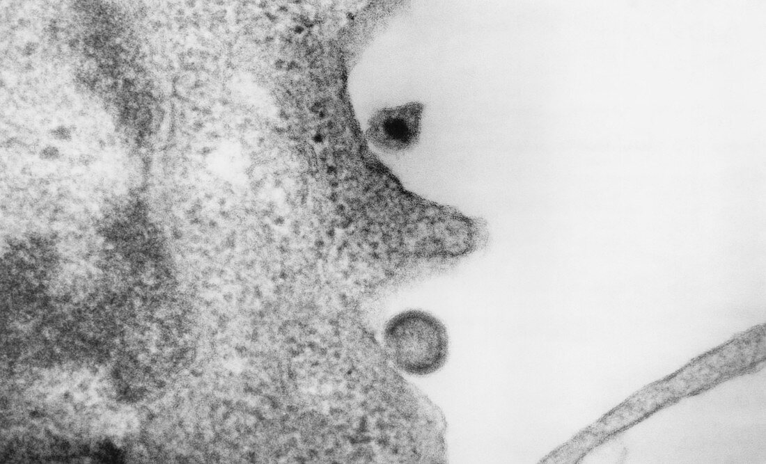 TEM of AIDS virus budding from H9 cell