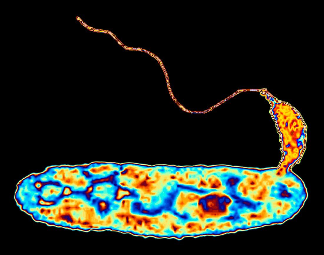 Bacteria (Bdellovibrio bacteriovorus)