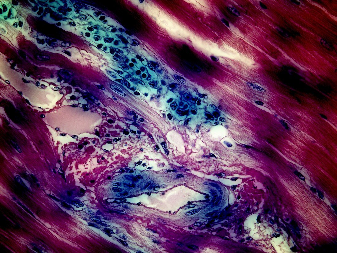 Cardiac muscle and other tissues, light micrograph