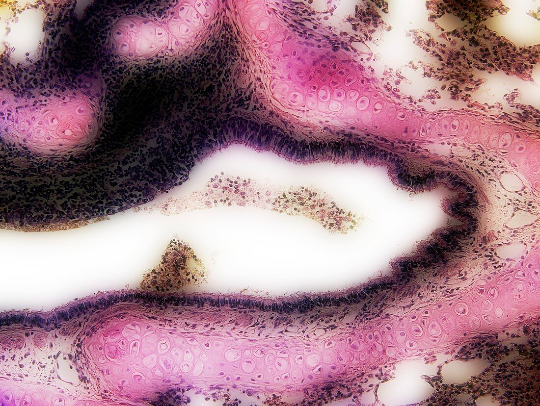 Bronchus in lung tissue, light micrograph