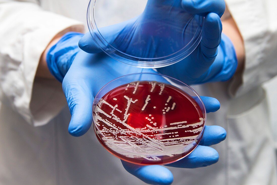Staphylococcus aureus culture