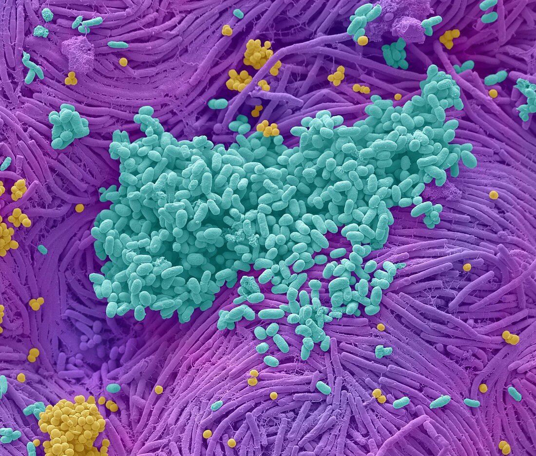 Bacteria found on mobile phone, SEM