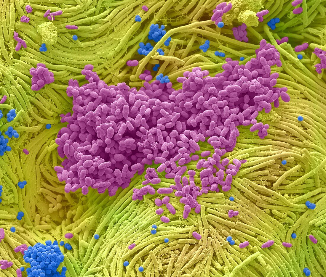 Mobile phone bacterial culture, SEM