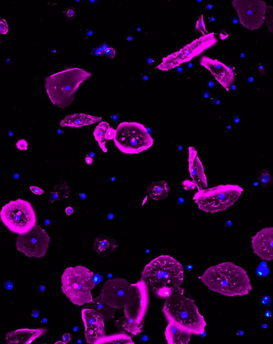 Fruit fly immune system cells, fluorescence micrograph